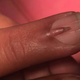 Illustration for article titled Here Is a Teeny Nail Growing on Top of Another Nail on Someones Middle Finger